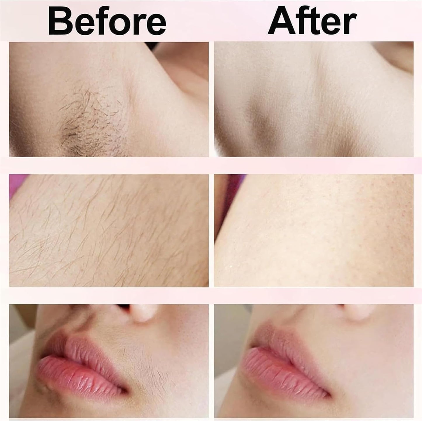 Electric 2 in 1 Lady Razor