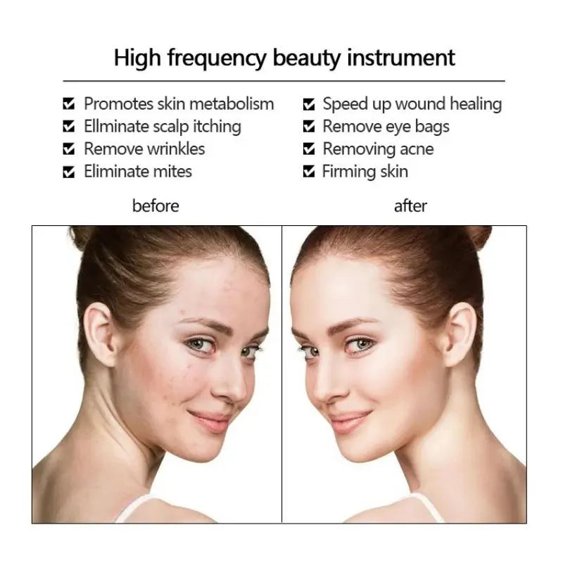 High Frequency Facial Wand Micro