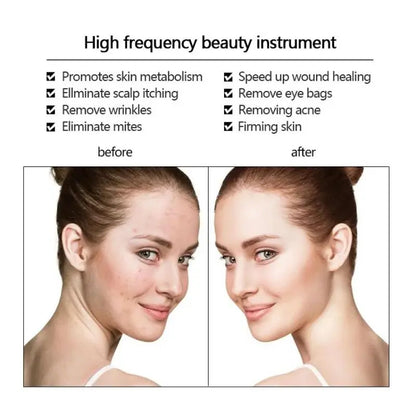 High Frequency Facial Wand Micro